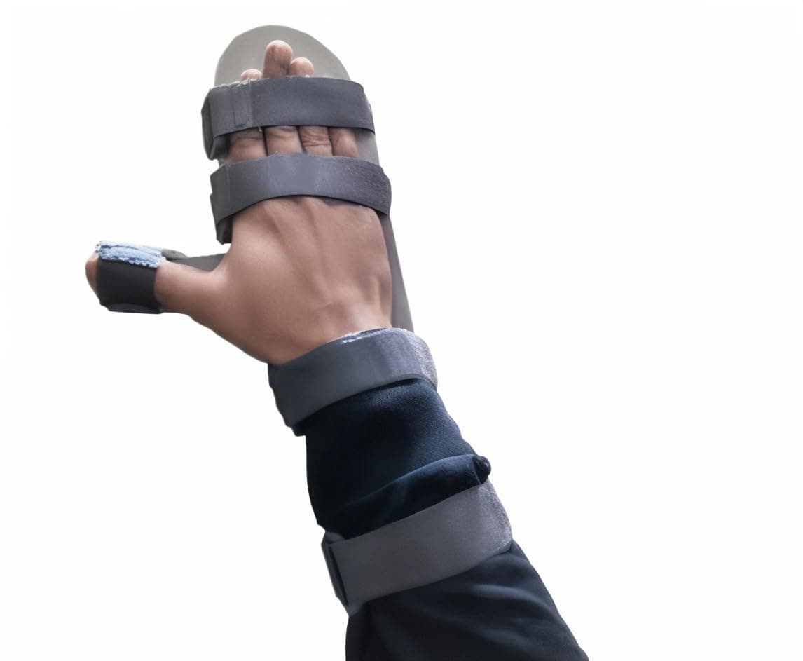 - Wrist Hand Support Static Cockup Splint for Stroke, Paralysis, Arthritic Diseases, and Fractures (For Right Hand, L)