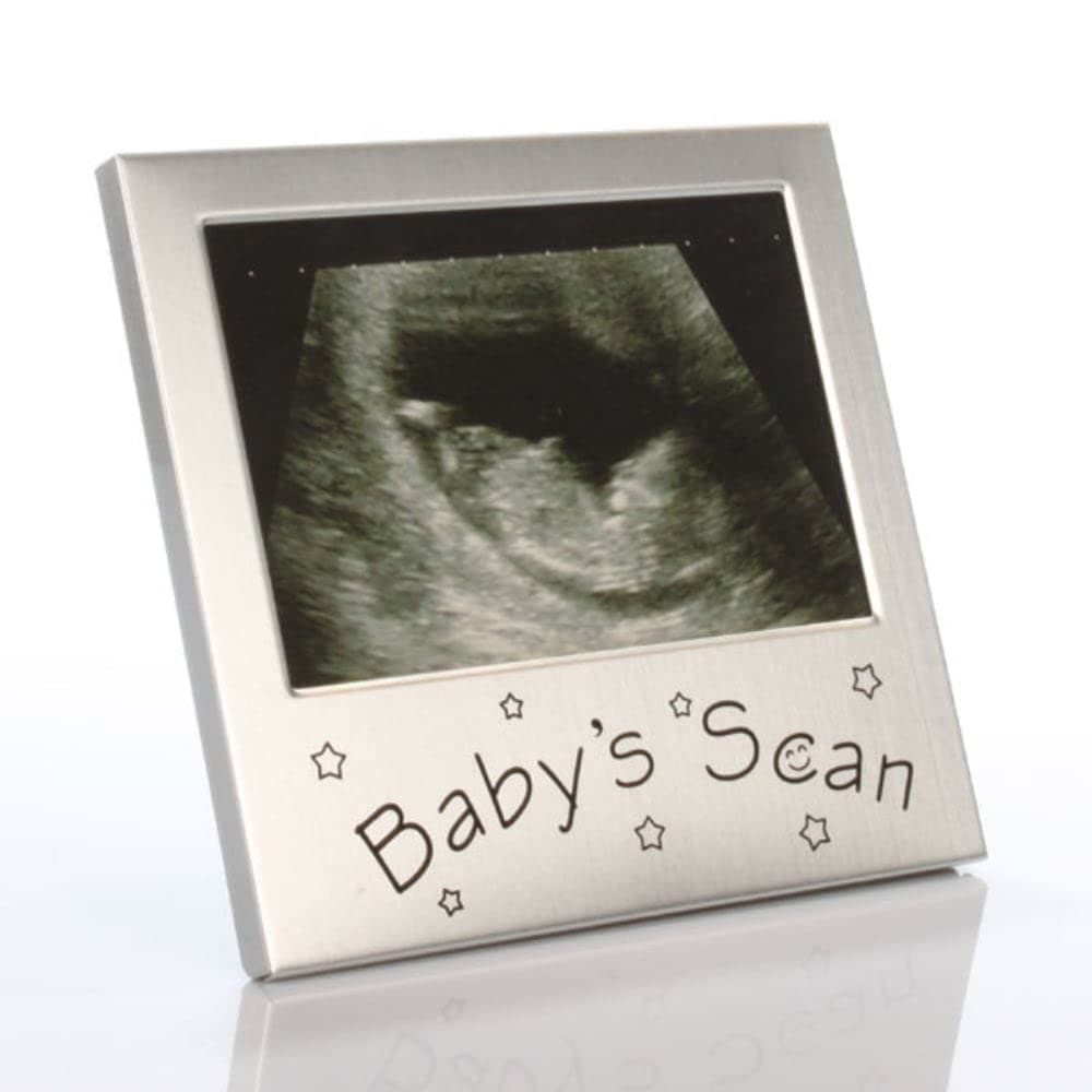The Gift Experience Baby Scan Frame | Okay, so it may be indecipherable by anyone other than you and your partner, but your baby's first scan is absolutely priceless!