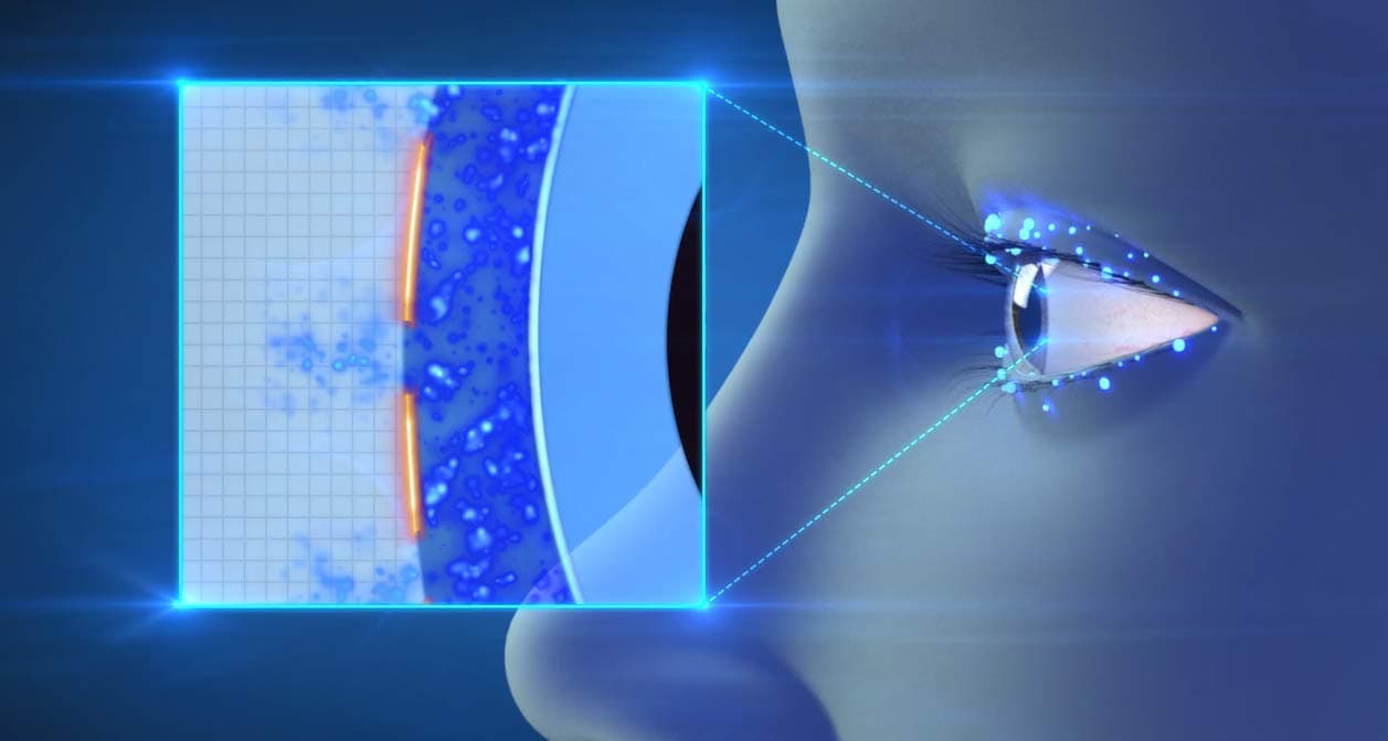 Optone Actimist Double Action Dry Eyes Spray