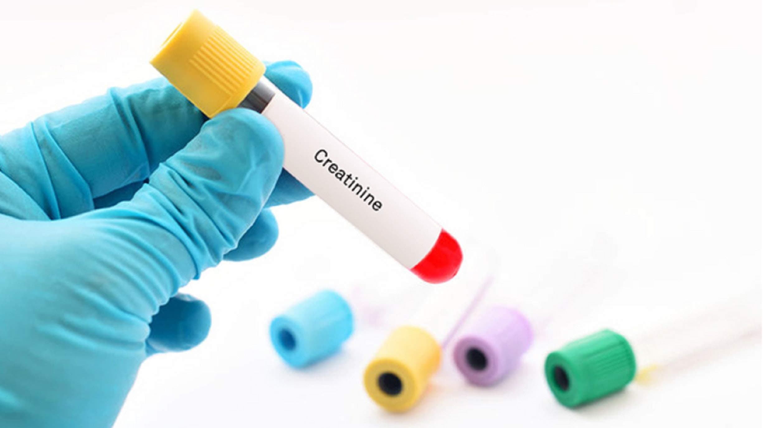 Zyrex Natural Creatinine Reducer Tablets-120 Tablets A Herbal Creatine Reducer Remedy For Kidney Patients For All Ages Men and Women. It Reduces Craetinine Level Natrually. 100% Herbal and Safe