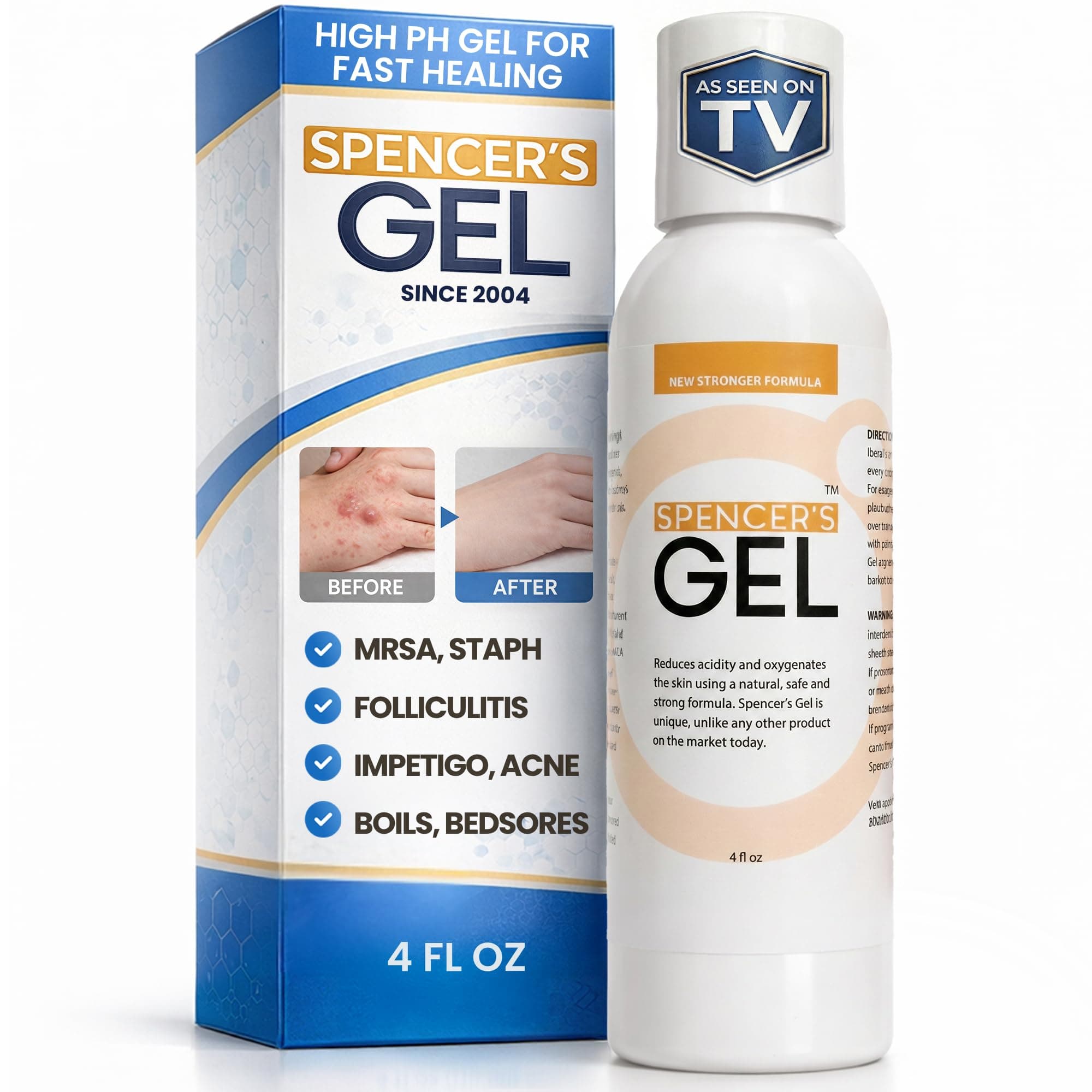 - Spencer's Gel Alkaline Formula (4 oz) Since 2004 The Only High-pH Solution for Stubborn Skin Issues (Boils, Furuncles, Ulcerations, Pressure Wounds, etc.) Non-Stinging, Fast-Acting