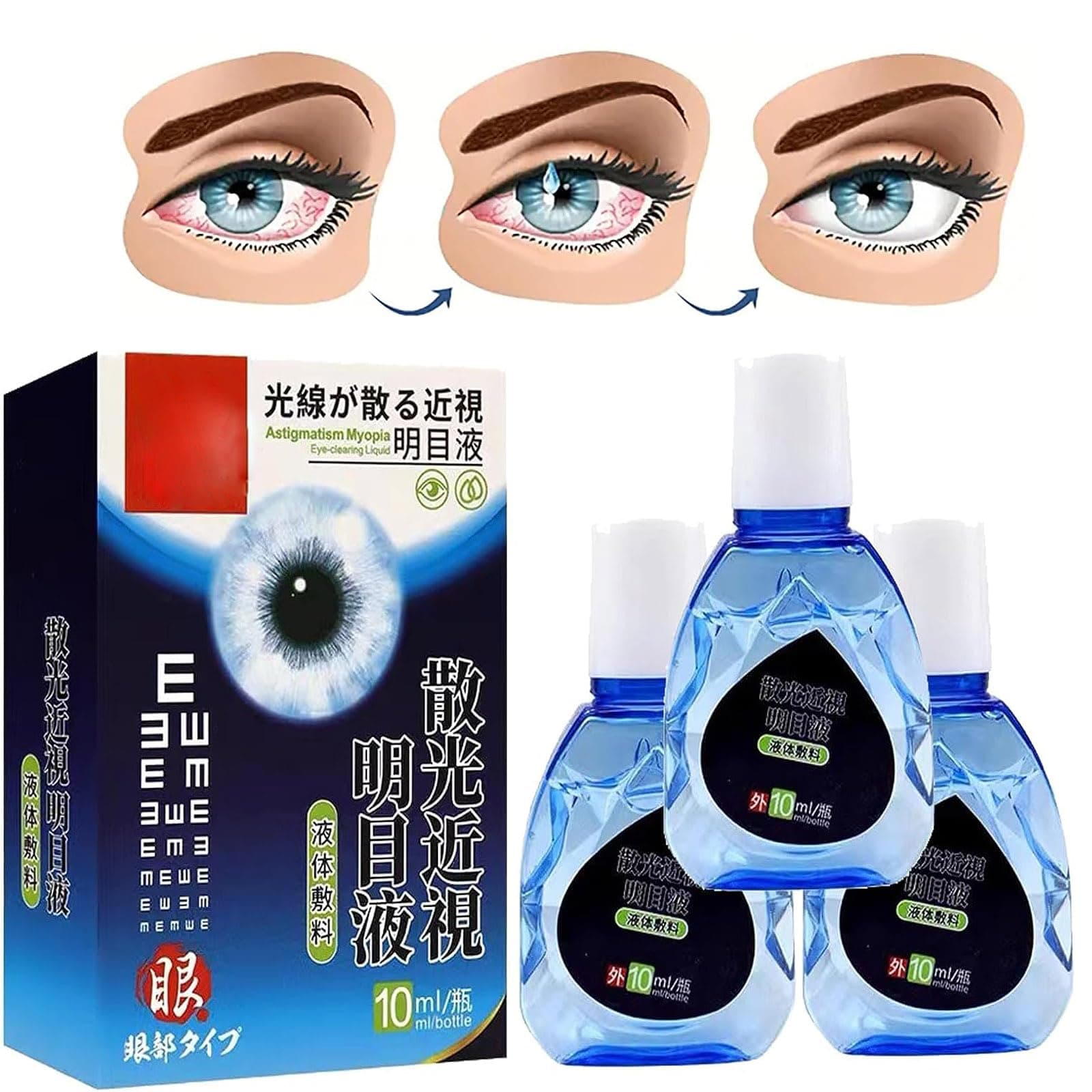 ATTDX Treatment EyeProblems SolutionDrops, Eye Therapy Drops, Eye Drops for Dry Eyes, Best Moisture Eye Drops, Eye Care Brightening Solution Japanese (3pcs)