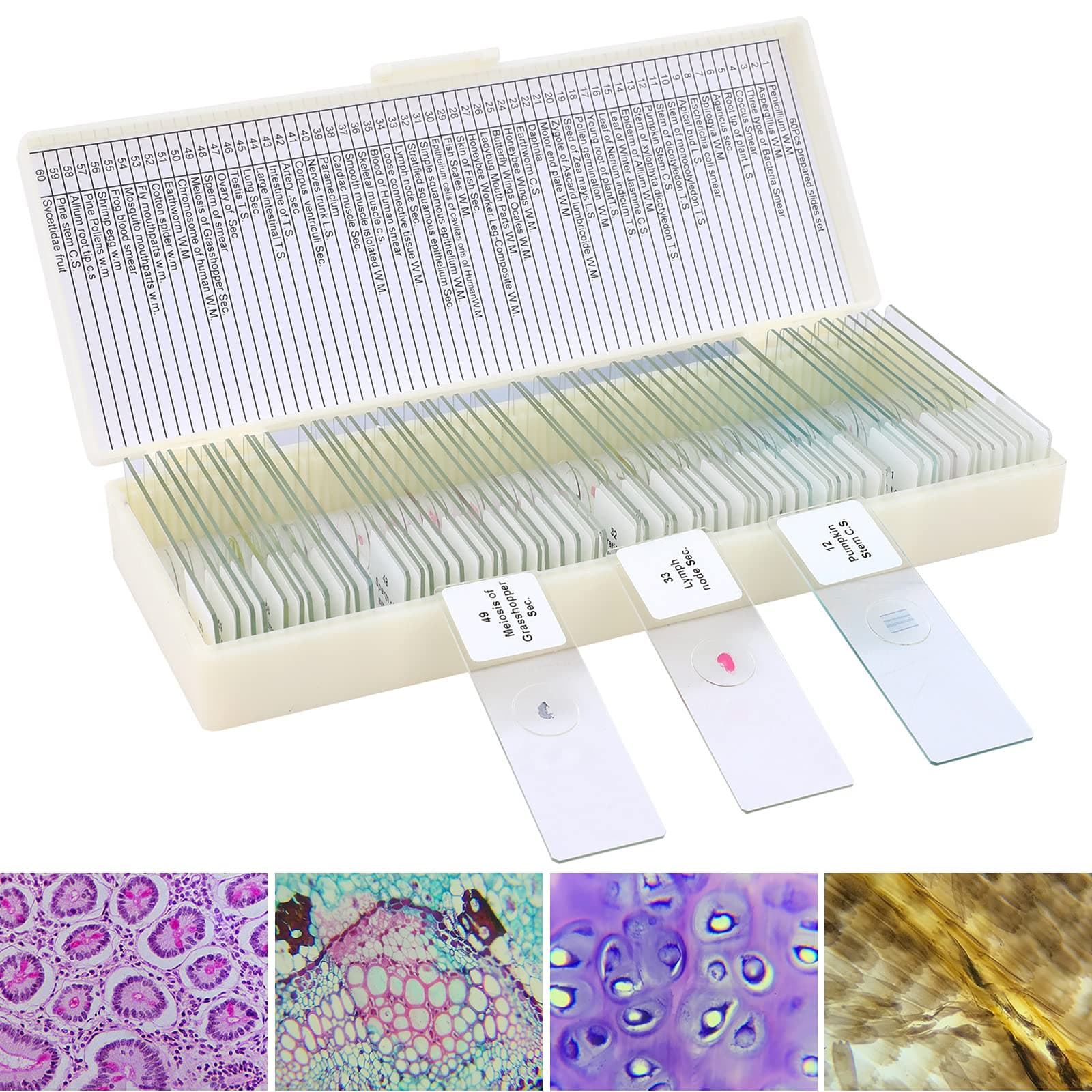 60 Microscope Slides with Specimens
