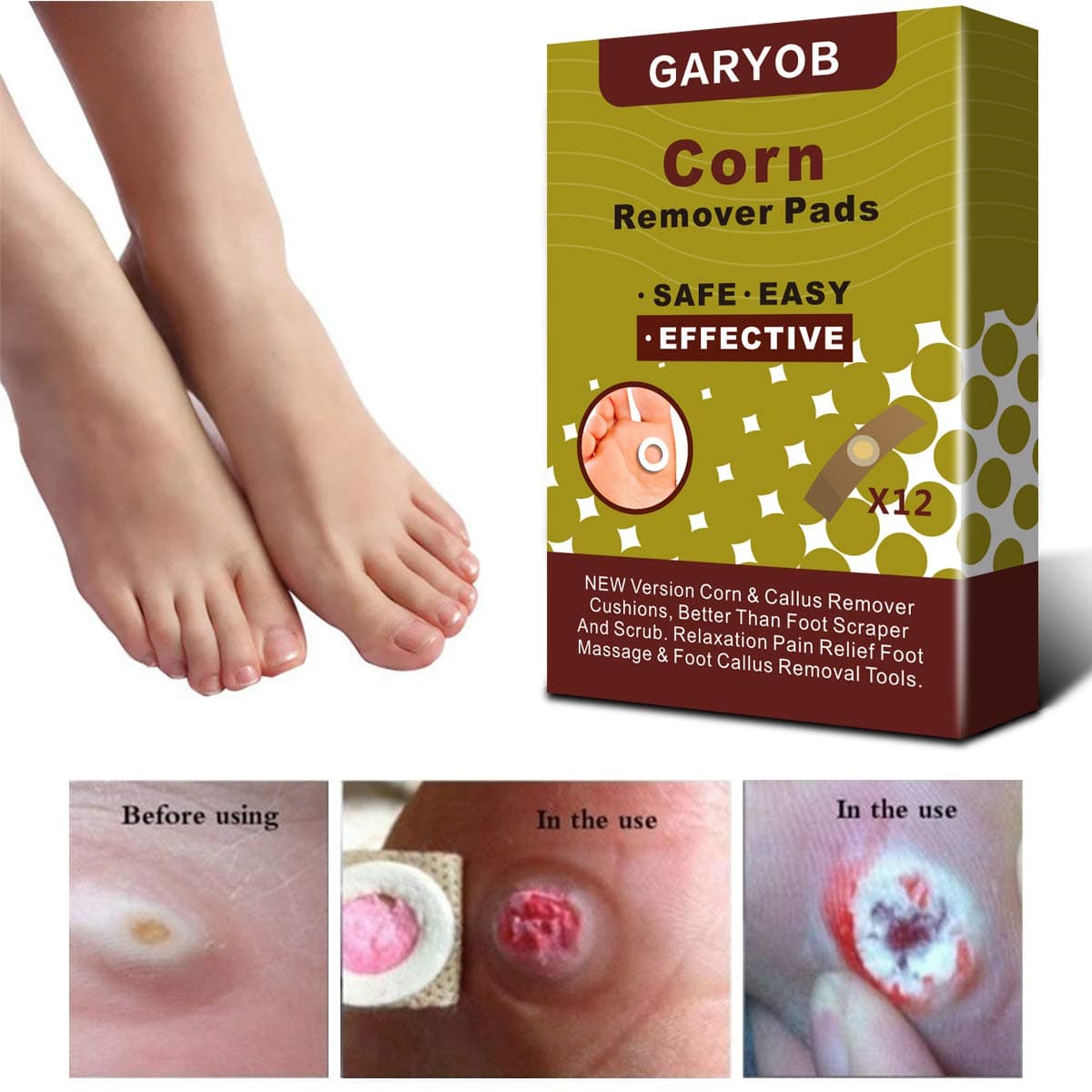 Corn Remover, Foot Corn Remover Pads, Corn & Callus Remover Cushions, Corn Plaster with Hole (12pc)
