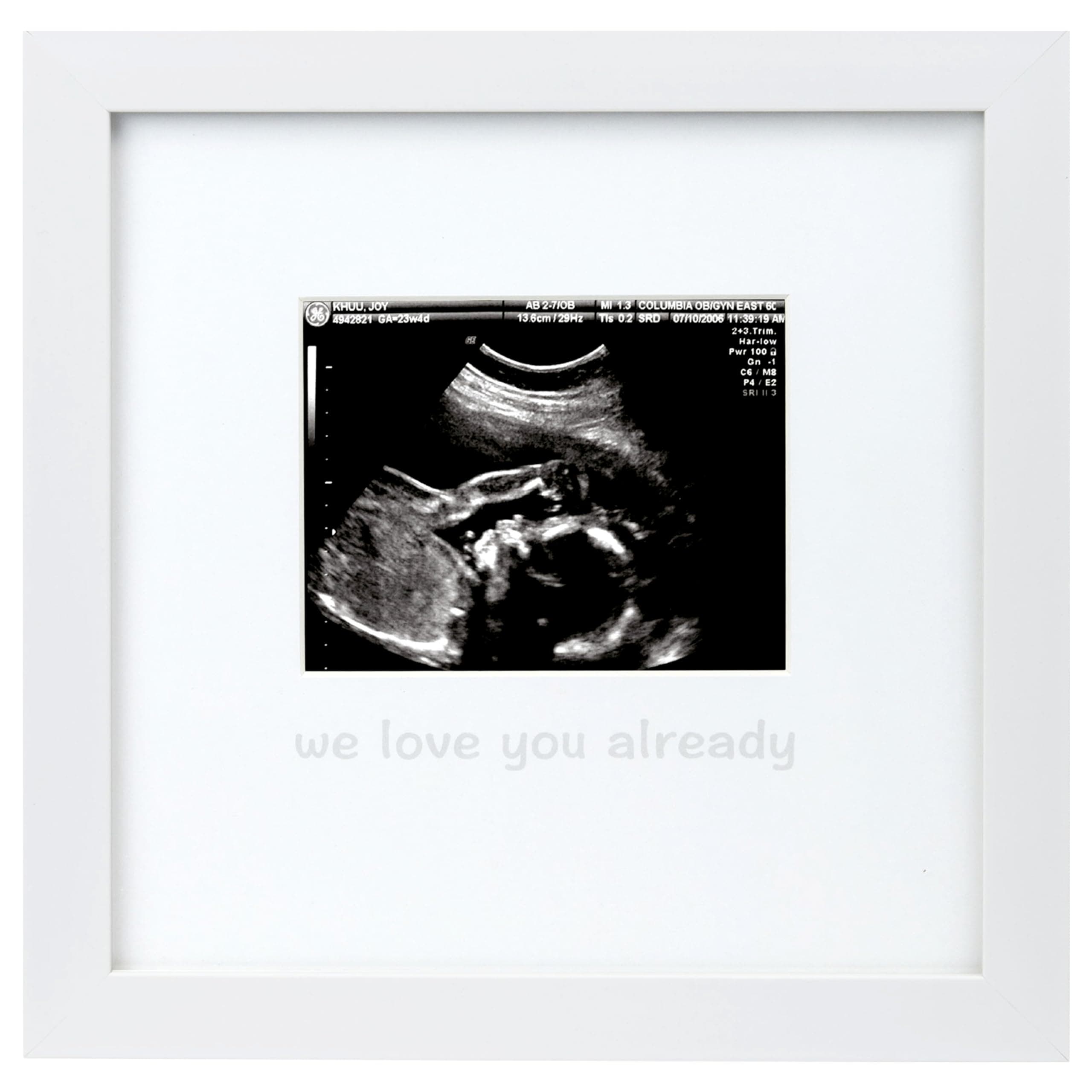 Tiny Ideas We Love You Already Sonogram Sentiment Frame, Baby Announcement, Gender Neutral Ultrasound Keepsake, Ideal Pregnancy Gift, Baby Shower and Nursery Decor, 4”x5” Photo Insert, White